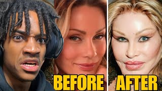 10 Plastic Surgeries That Went HORRIBLY Wrong [upl. by Aivatco170]