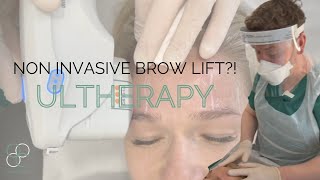 Non Invasive BROW LIFT with ULTHERAPY Does it ACTUALLY work [upl. by Siletotsira]