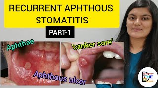 RECURRENT APHTHOUS STOMATITIS RAS PART1 [upl. by Assetal866]