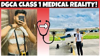 DGCA CLASS 1 MEDICAL 🏥 My Experience😱pilot aviation medical dgca [upl. by Eelnodnarb]