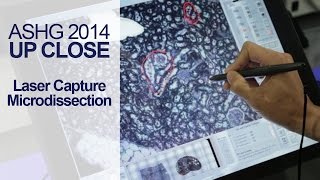 Introduction to Laser Capture Microdissection LCM  ASHG 2014 [upl. by Novel404]