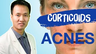 Corticoids  Liệu BẠN đã HIỂU ĐÚNG về tại biến  tác dụng phụ  Dr Hiếu [upl. by Harle349]