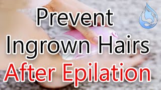 How to Prevent Ingrown Hairs After Epilation [upl. by Siclari]