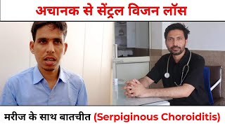 Serpiginous Choroiditis White Dot Syndrome अचानक से आंख की रोशनी चले जाना Loss of Central vision [upl. by Rowell]