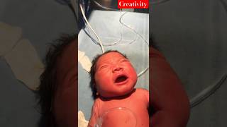 Newborn Baby position Changed Video nicu medical viralvideo [upl. by Alecram408]