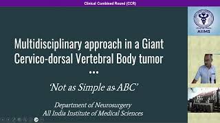 Giant CervicoDorsal Aneurysmal Bone Cyst  Clinical Combined Rounds  AIIMS New Delhi [upl. by Jojo]