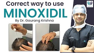 Minoxidil hack how to use it without getting your hair all greasy [upl. by Sidalg]