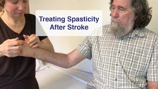 Treating Spasticity after Stroke [upl. by Elaynad561]