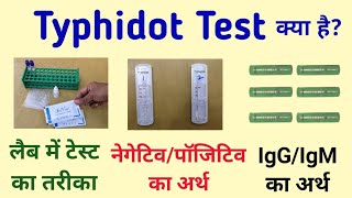 Typhidot test  Typhoid test  typhidot igm igg positive means in hindi [upl. by Eidson952]