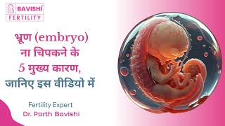 भ्रूण embryo ना चिपकने के 5 मुख्य कारण जानिए इस वीडियो में  Dr Parth Bavishi [upl. by Nocaj121]