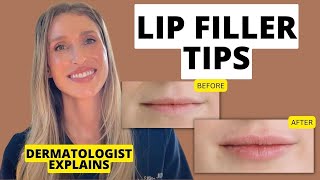 Dermatologist Shares 9 Lip Filler Tips to Know Before and After Treatment [upl. by Leahci]