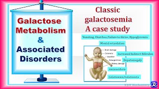 22 Galactose metabolism amp Associated Disorders  carbohydrates Metabolism  Biochemistry [upl. by Alliscirp]