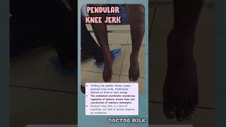 Pendular knee jerk neetpg usmle [upl. by Danice357]