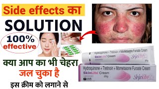 skin light cream के साइड इफेक्ट को ऐसे ठीक करें  skinlite cream side effects ko kaise thik kare [upl. by Annaoj]