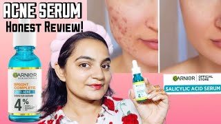 Garnier Fast Clear Serum for Acne Prone Skin  Honest Review [upl. by Aremahs843]