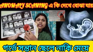 How to know baby boy or girl in ultrasound report আল্ট্রাসাউন্ড বলে দেবে ছেলে না মেয়ে সন্তান হবে [upl. by Orford]