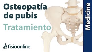 Cómo tratar la Osteopatía de pubis Quirúrgico y conservador [upl. by Feinleib]