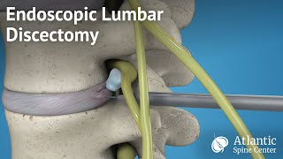 Lumbar spine MRI scan protocols positioning and planning [upl. by Luy]