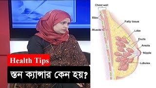 স্তন ক্যান্সার কেন হয়  Breast Cancer  Health Tips  Somoy TV [upl. by Kelcey71]