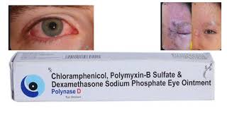 Dexamethasone eye ointment  Polynase D  uses  Optometry solution [upl. by Anaujit]