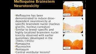 Mefloquine Presentation by Dr Remington Nevin [upl. by Lipson933]