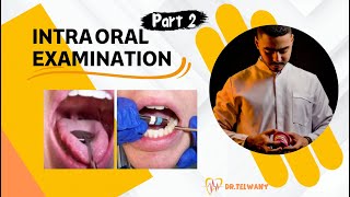 IntraOral Examination  part 2 [upl. by Eizeerb]