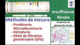 Méthodes de Mesure Protéinurie des 24h Hématurie sang dans les urines bilan urinaire [upl. by Leiuqese]