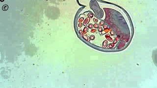 Trichuris trichiura cross section [upl. by Selrahc]