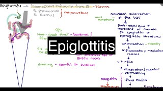 Epiglottitis [upl. by Backer523]