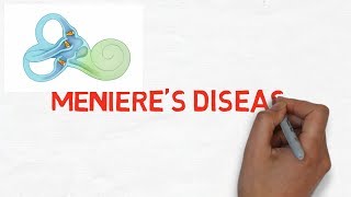 Minieres Disease lecture [upl. by Nova141]