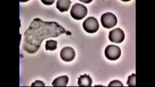 Neutrophil Phagocytosis  White Blood Cell vs Staphylococcus Aureus Bacteria [upl. by Phina]