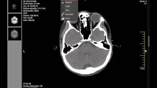 Multiplatform Dicom Viewer [upl. by Bush925]