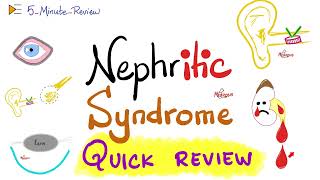 Nephritic Syndrome  APSGN RPGN IgAN Alport  Quick Review  5 Minute Review Series [upl. by Chow237]