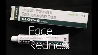 ClopG Cream for face Redness reactionReview in hindi [upl. by Gies2]