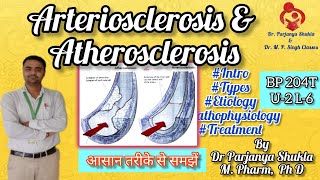 Arteriosclerosis and Atherosclerosis  Intro Types Etiology Pathophysiology BP 204T U2 L6 [upl. by Yar468]