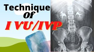 Technique of IVUIVP Ep36 Intravenous urogrampyelogram Procedure of IVUIVP test [upl. by Ltney]