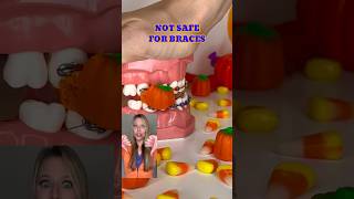 FOODS YOU CAN  CANT EAT WITH BRACES ON 👀 FALL Edition Orthodontist REACTS CRUNCHY CANDY FOOD ASMR [upl. by Aztinaj]