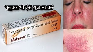 melamet cream use and sadi effect इस क्रीम की सच्चाई [upl. by Gona189]