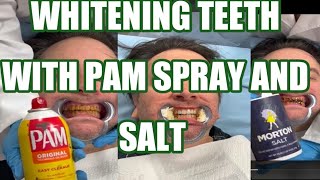 whitening teeth with pam spray and salt [upl. by Ecnaled24]