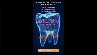 A DAY IN THE LIFE OF AN ENDODONTIST A REAL LIFE CHRONICLE OF A SINGLE DAY IN ENDO PRACTICE [upl. by Dulcy824]