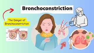 Bronchoconstriction Care and Management [upl. by Adnyleb248]