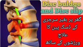 Backpain treatment by dr warda  S6  Exercises for disc pain  UrduHindi [upl. by Zzaj]