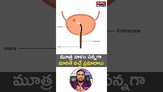 Struggling to Pee Understanding a Narrow Urine Passage Urethral StrictureDr Raviteja Ramisetty [upl. by Karil]