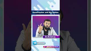 Kwashiorkor Vs Marasmus  Quick Bites [upl. by Oecile]