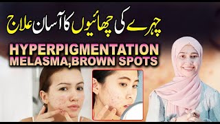 cover dark circles hyperpigmentation acne scars treatment  melasma treatment at home acnescars [upl. by Pimbley]