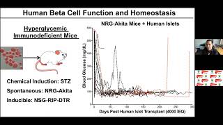 Webinar Exploring Humanized Mouse Models for Diabetes Research and Beyond [upl. by Cari]