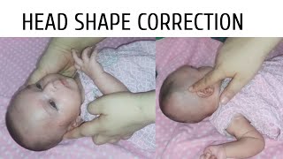 Baby Head Shape Correction  Flat Head Syndrome  Flat Head Prevention [upl. by Kinimod115]