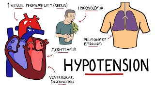 Causes of Hypotension  What causes Low Blood Pressure with Signs and Symptoms [upl. by Norod]