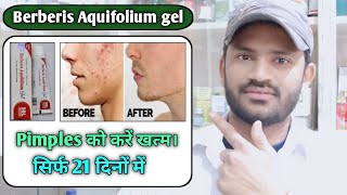 Berberis Aquifolium gel use dose benefits and Side effects full review in hindi [upl. by Lamraj]