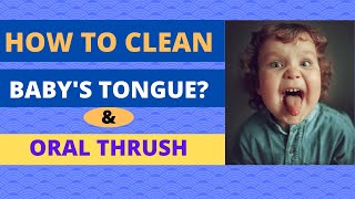 How to clean baby’s tongue  What’s oral thrush  drnilesh [upl. by Relyuhcs]